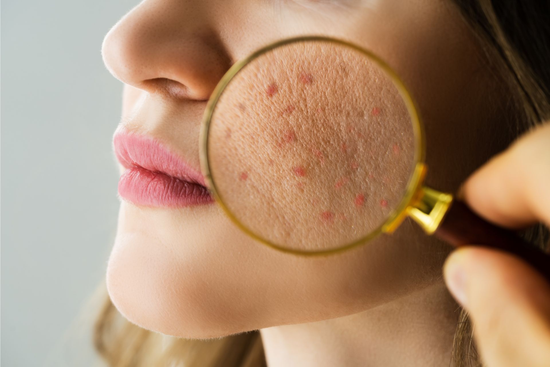 Ayurvedic Skin treatment for Sensitive Skin